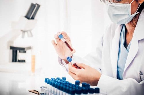 Một số chỉ số hoá sinh thường gặp