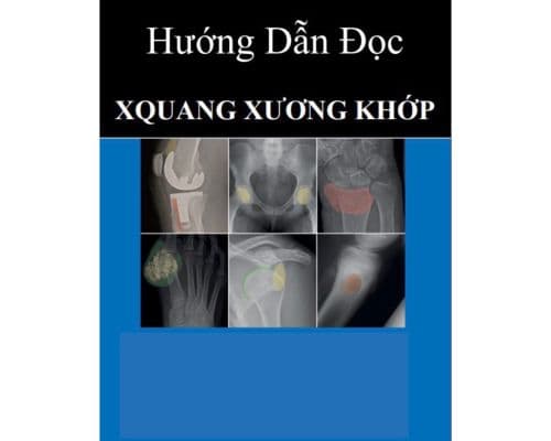 Hướng dẫn đọc xquang xương khớp